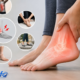 Sudden Ankle Pain Without Injury or Swelling
